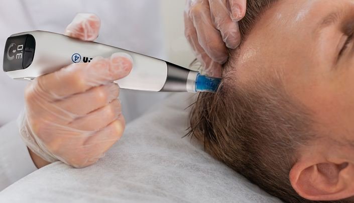 Micro Needling at Dr Sree Healthcare