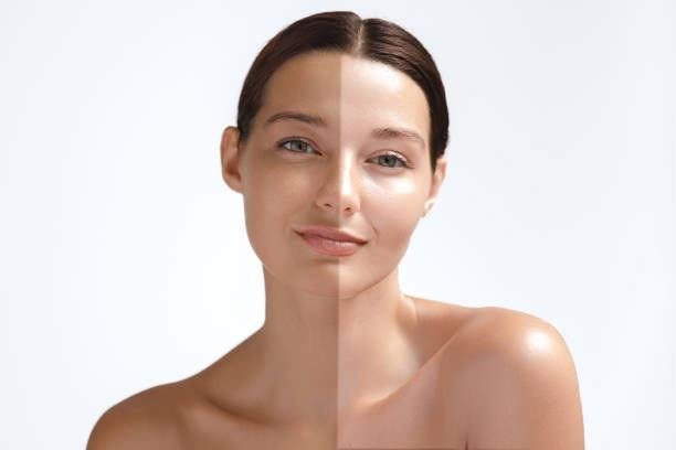 Skin Brightening at Dr Sree Healthcare